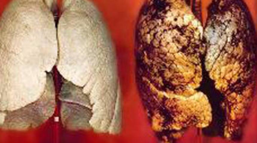 Resimli uyarı, sigara paketlerine giriyor