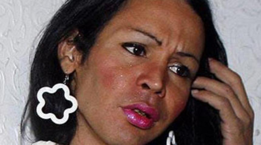 Skandal transekss&uuml;ele diri diri yaktılar