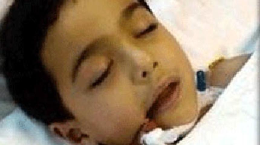 Kolu kırılan &ccedil;ocuk &ouml;ld&uuml;