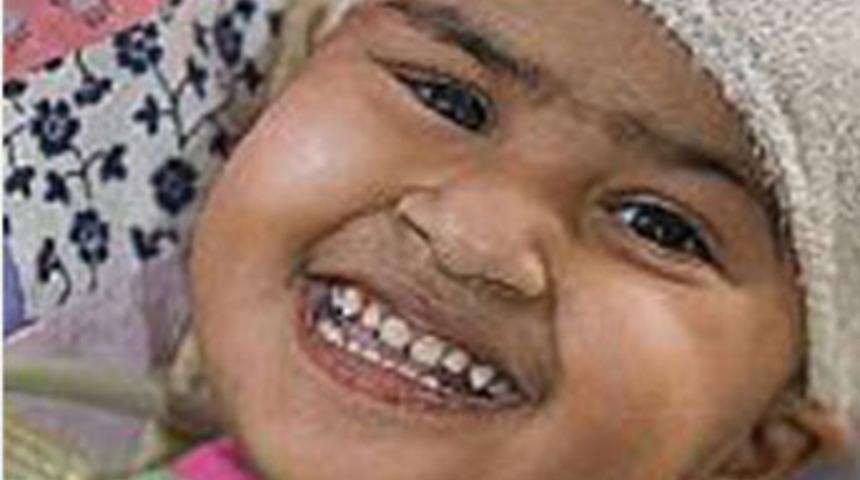 Başları birbirinden ayrılacak