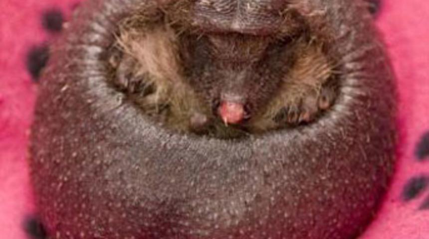 Dikensiz doğdu annesi terk etti!