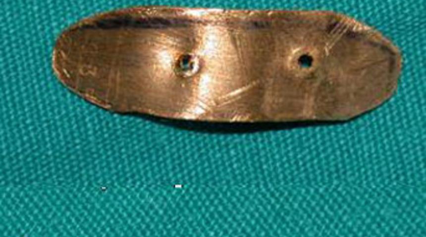 G&ouml;z kapağına 24 ayar altın