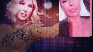 Yüzüne sünnet derisi enjekte ettirmişti! Seda Sayan canlı yayında açıkladı! Maliyeti dudak uçuklattı