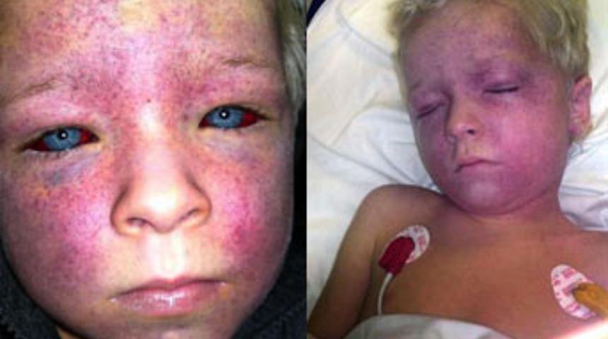 Y&uuml;r&uuml;yen merdiven bu hale getirdi