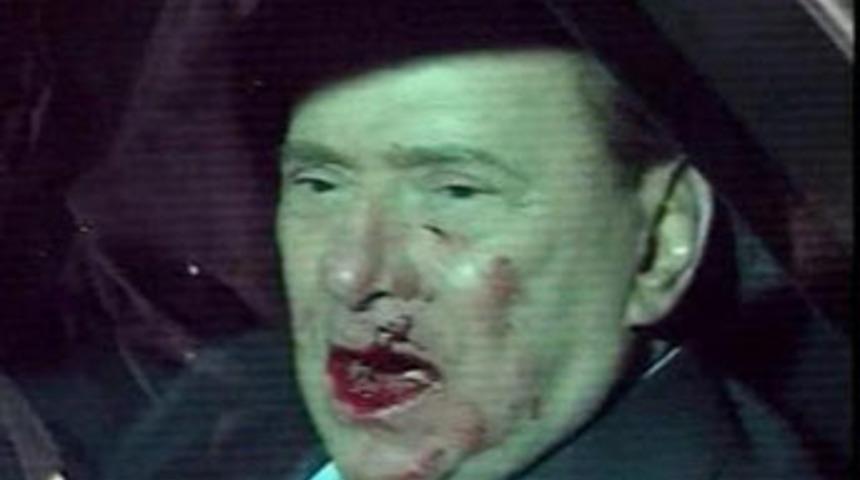 Saldırıda şok iddia