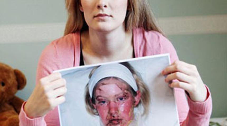 Y&uuml;z&uuml; tanınmaz hale geldi