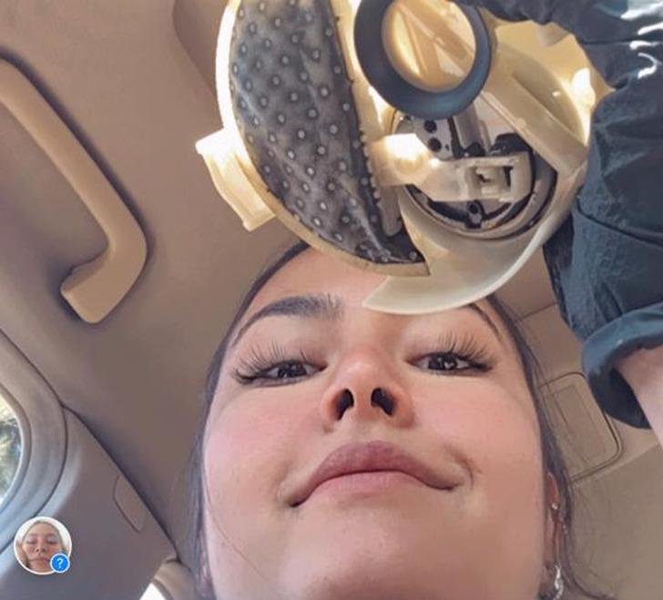 'Aynaya bakamıyorum, eski ben değilim artık' İş kazasında vücudunun yüzde 80'i yandı! 'Güneşe bile çıkamıyorum' G4