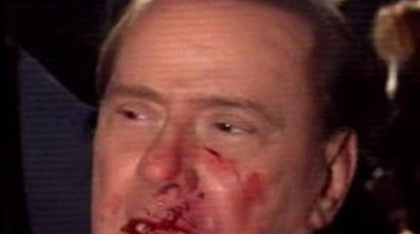 Berlusconi yumruk yedi dişleri gitti