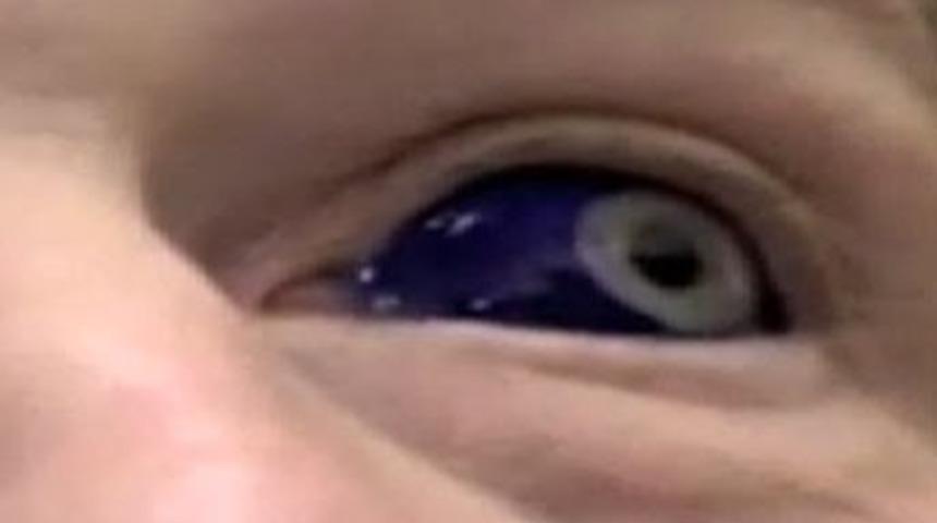 G&ouml;zlerinin 'i&ccedil;inde' d&ouml;vme var!