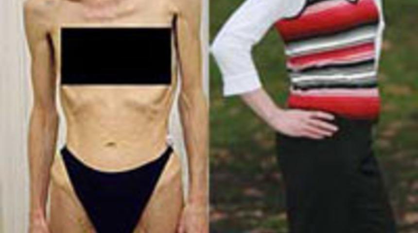 &Ouml;l&uuml;mden kurtaran fotoğraf!