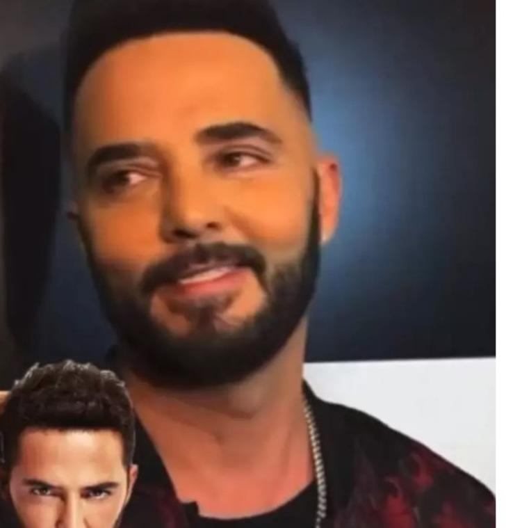 Yüzündeki değişim olay oldu! Gökhan Özen botoks iddialarına böyle cevap verdi G2