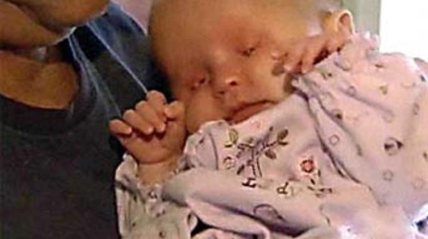 Bu bebeğin g&ouml;zleri yok