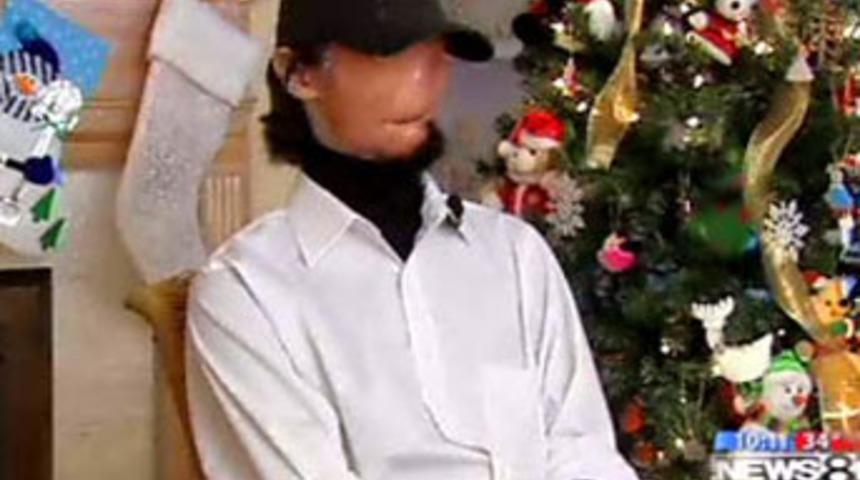 Y&uuml;zs&uuml;z adam yeni y&uuml;z istiyor