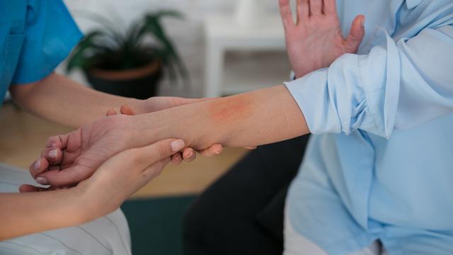 Sakın sürmeyin! Yanıklara böyle müdahale ediyorsanız hemen bırakın 'Aşırı şekilde arttırıyor' İşte kaynar su dökülünce ilk yapılması gerekenler