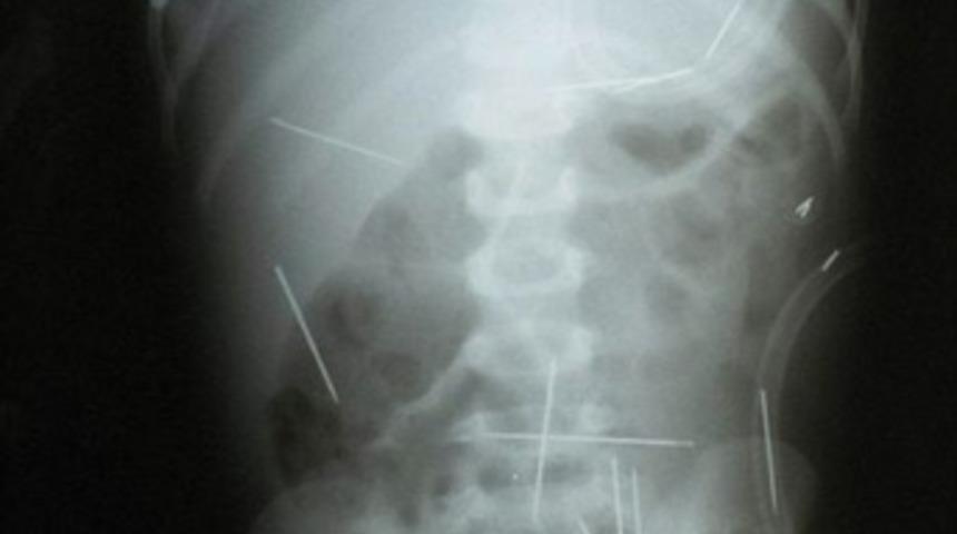R&ouml;ntgen filmindeki dehşet