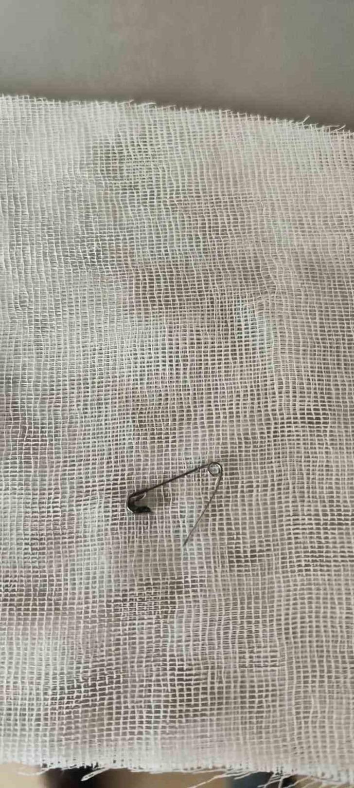 Bitlis'te 8 aylık bebeğin boğazına çengelli iğne kaçtı! Röntgen görüntüsünü gören şaştı kaldı G4