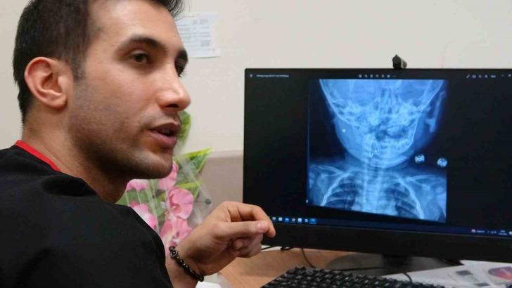 Bitlis'te 8 aylık bebeğin boğazına çengelli iğne kaçtı! Röntgen görüntüsünü gören şaştı kaldı G1