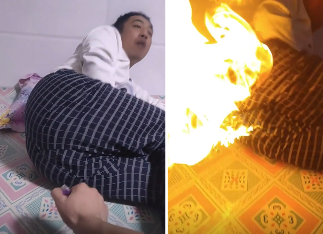 Şaka kabusa d&ouml;nd&uuml;! Gaz &ccedil;ıkarttığı anda &ccedil;akmağı ateşledi... Bir anda alevler t&uuml;m pantolonunu sardı