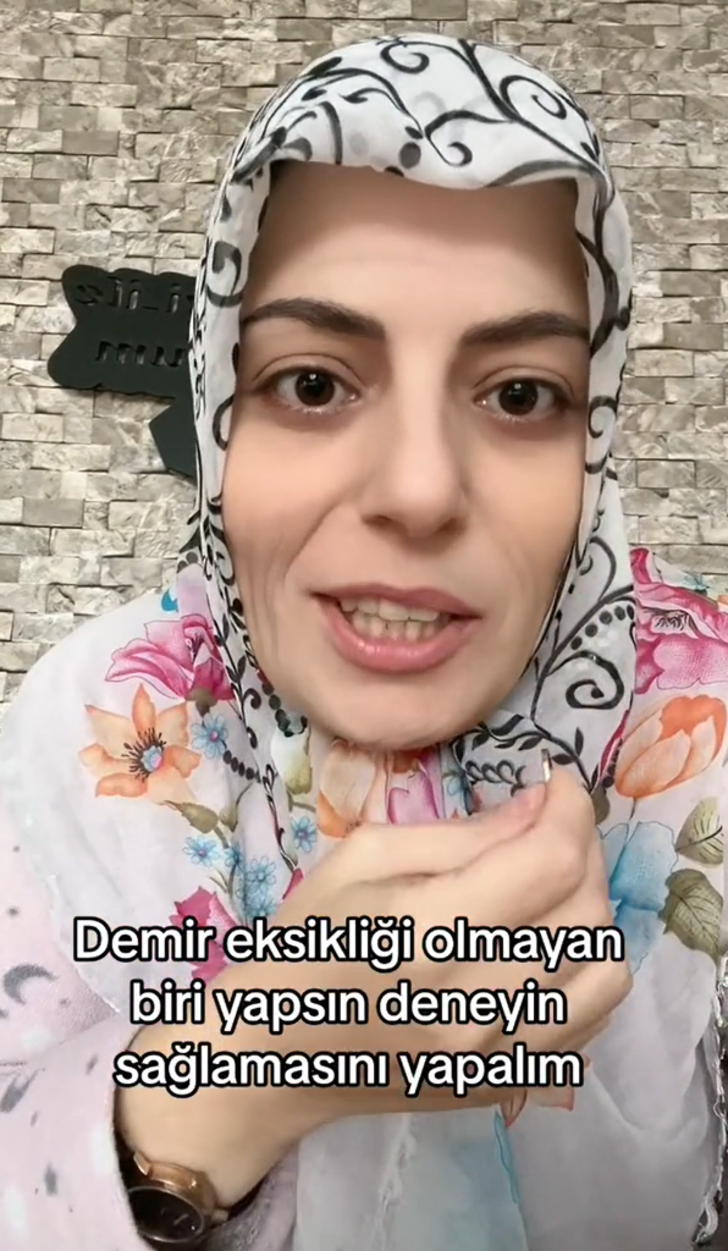 TikTok'u kasıp kavuran 'altın yüzükle demir eksikliği' testinin gerçeği ortaya çıktı!  Nedeni bambaşkaymış... Bazısında siyah çizgi çıkıyor bazısında çıkmıyor G5