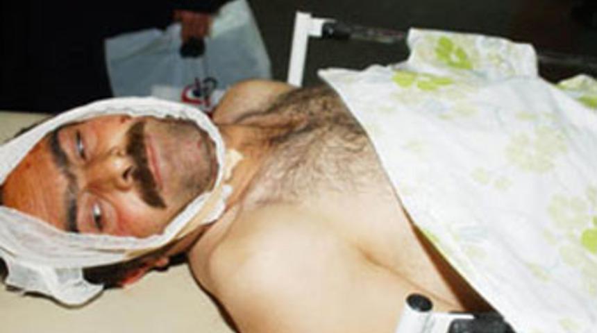 'Benim karım Dudu' dedi, eşinden bı&ccedil;ağı yedi