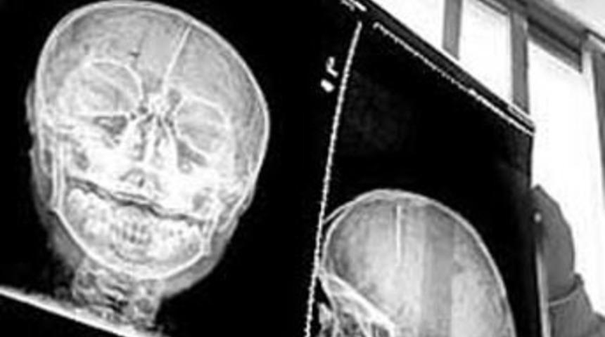 Erkek doğmadığı i&ccedil;in cezalandırıldı!