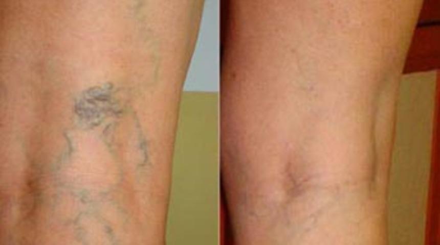 &lsquo;Varis&rsquo;i hafife almayın