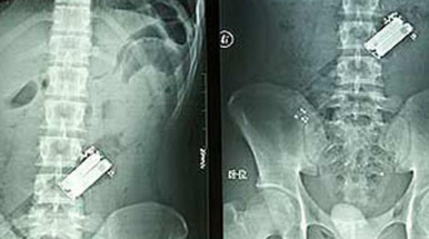 Sarhoş oldu, kumandayla uyandı!