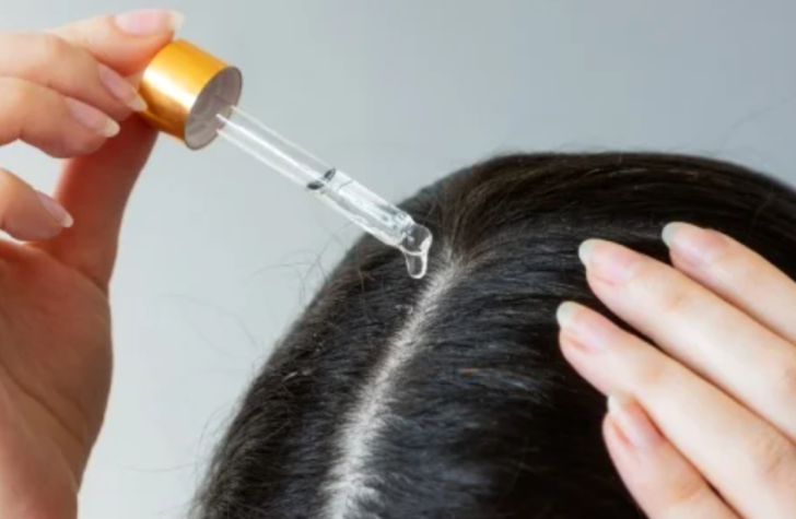 Kepeğe karşı en etkili formül! Sadece 2 malzeme kepeğin kökünü kazıyor, tekrar oluşumunu engelliyor G4