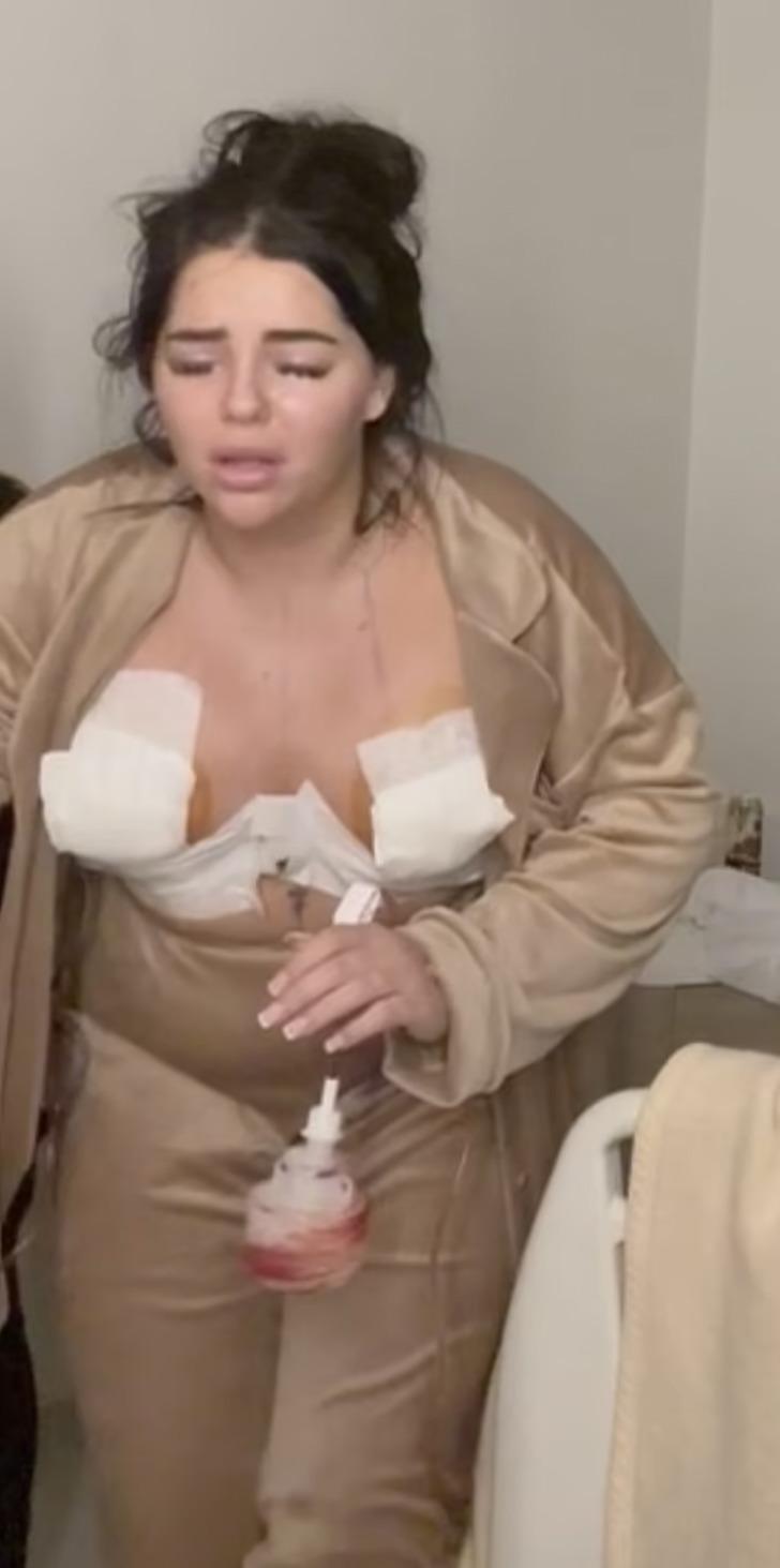 Meme dikleştirme ameliyatı için Türkiye'ye geldi, hayatı kabusa döndü! Arkadaşları meme uçlarının görüntülerini paylaştı G4