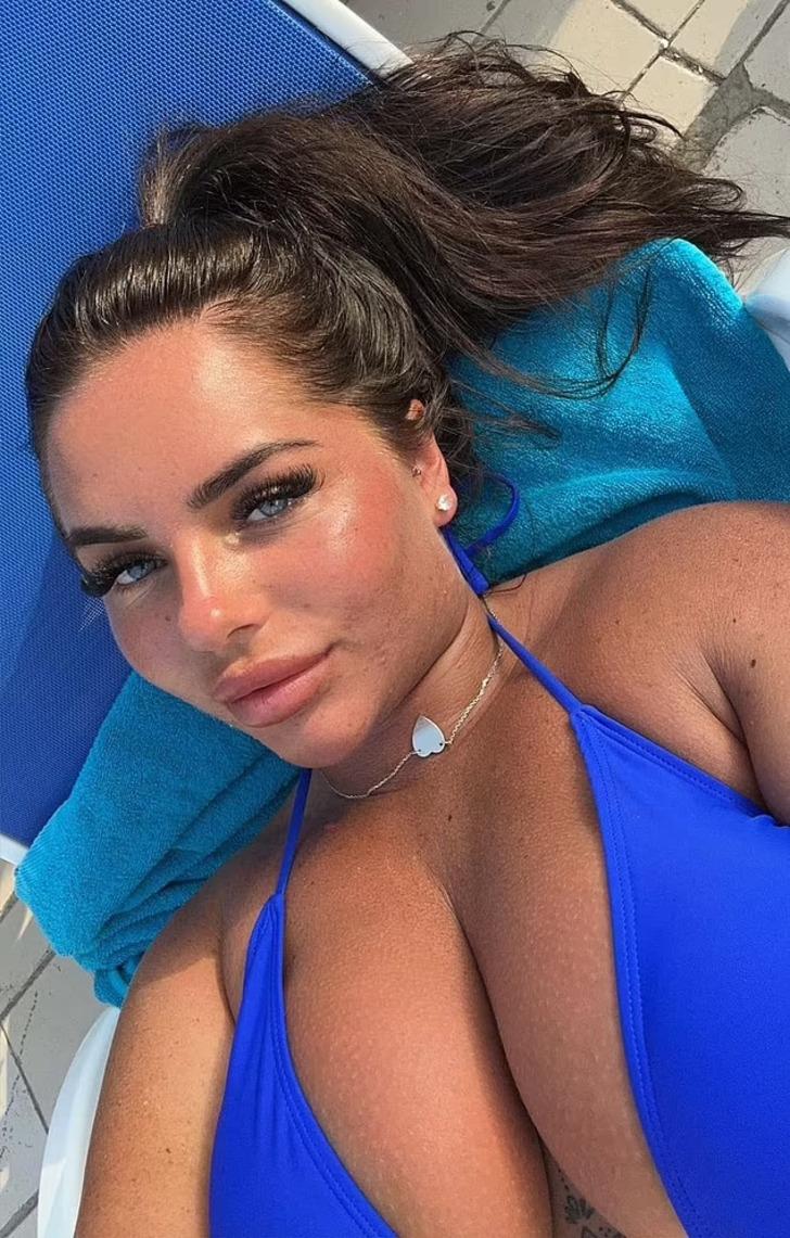 Meme dikleştirme ameliyatı için Türkiye'ye geldi, hayatı kabusa döndü! Arkadaşları meme uçlarının görüntülerini paylaştı G3