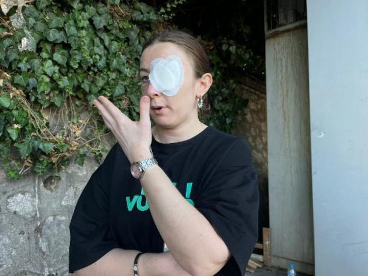 Eski sevgilisini eğlence mekanında görünce deliye döndü! 'Cinsel içerikli mesajların' ardından bir detay daha ortaya çıktı: 'Vücudumda defalarca sigara söndürdü' G2