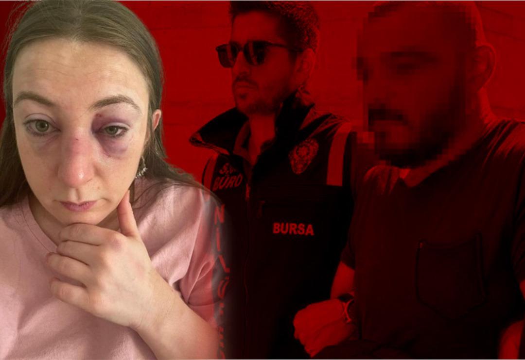 Eski sevgilisini eğlence mekanında g&ouml;r&uuml;nce deliye d&ouml;nd&uuml;! 'Cinsel i&ccedil;erikli mesajların' ardından bir detay daha ortaya &ccedil;ıktı: 'V&uuml;cudumda defalarca sigara s&ouml;nd&uuml;rd&uuml;'