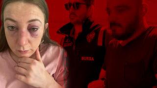 Eski sevgilisini eğlence mekanında görünce deliye döndü! 'Cinsel içerikli mesajların' ardından bir detay daha ortaya çıktı: 'Vücudumda defalarca sigara söndürdü'