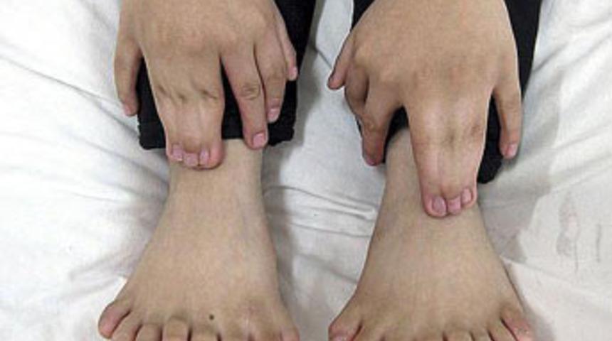 Tam 31 parmağı var!