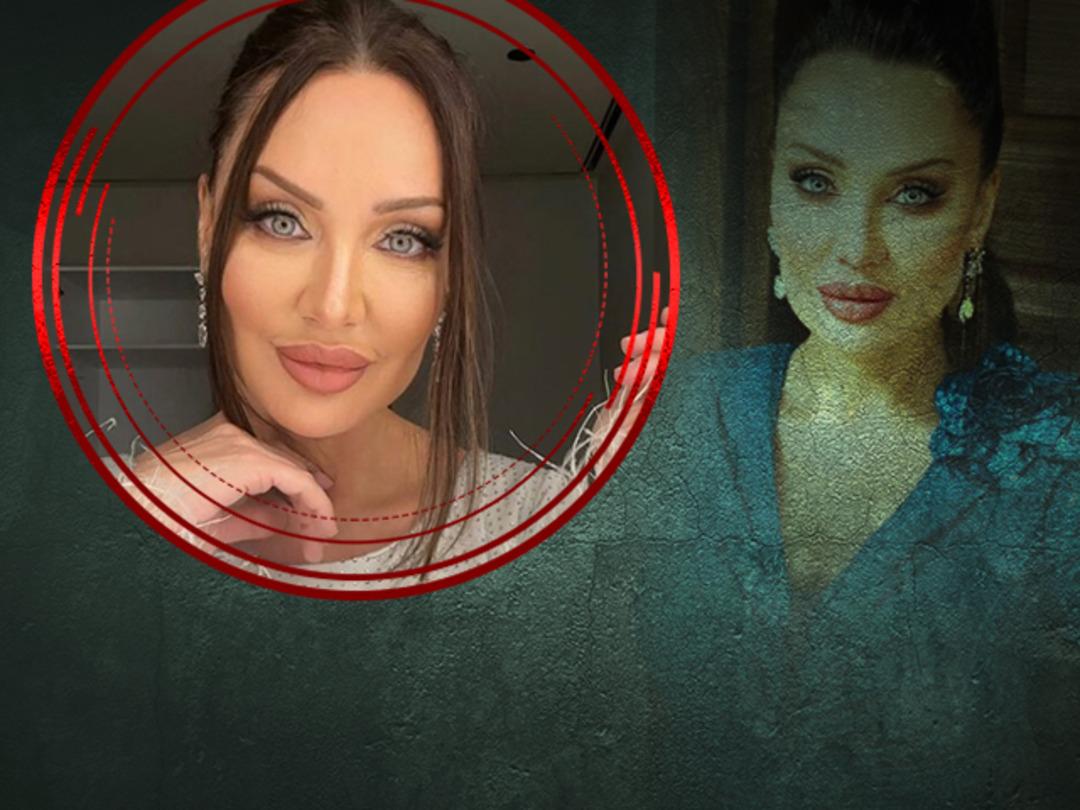 Alın daraltma ameliyatı olmuştu! Umut Aky&uuml;rek son halini paylaştı