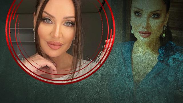 Alın daraltma ameliyatı olmuştu! Umut Akyürek son halini paylaştı