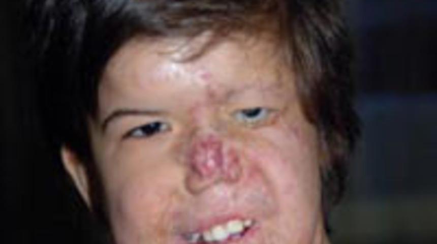 SGK'dan skandal yanıt