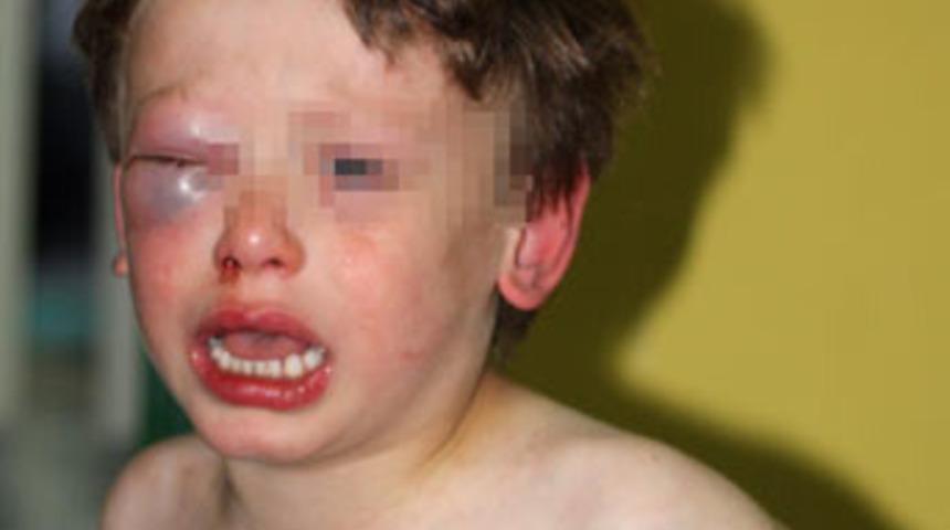 Şimdi de ka&ccedil;ırıldı