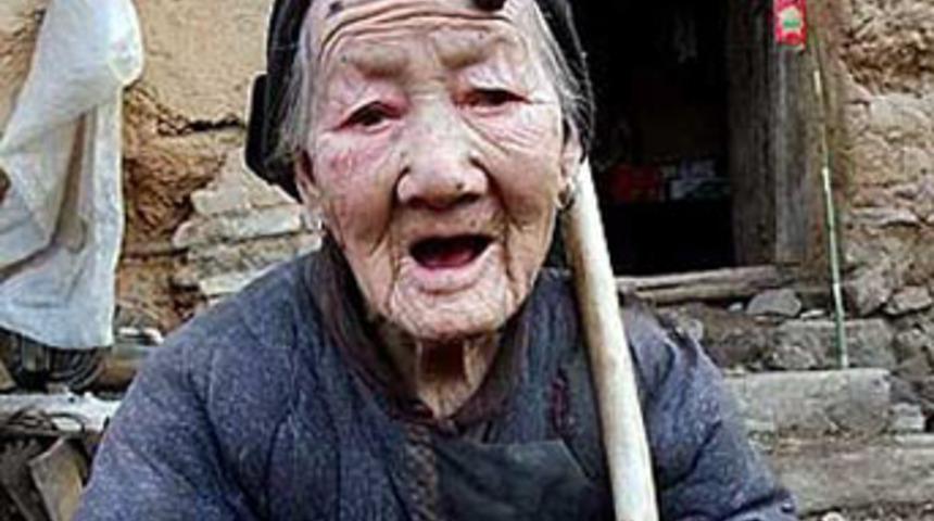 Yaşlı kadının "boynuz"u &ccedil;ıktı!
