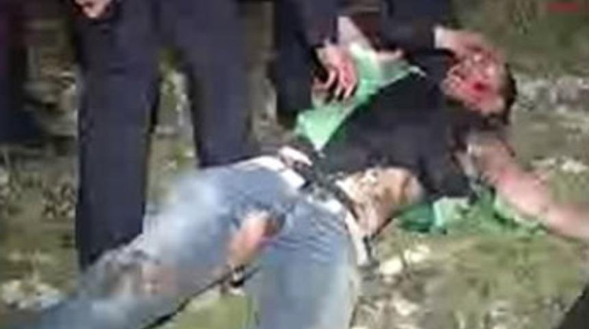 Yanık halde metrelerce y&uuml;r&uuml;d&uuml;