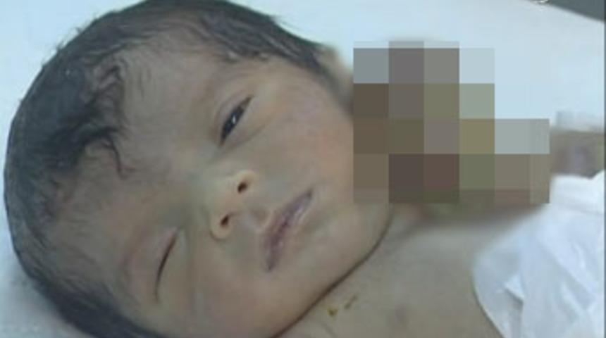 Bebek kalbi dışarıda doğdu