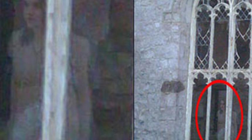 T&uuml;yler &uuml;rperten fotoğraf