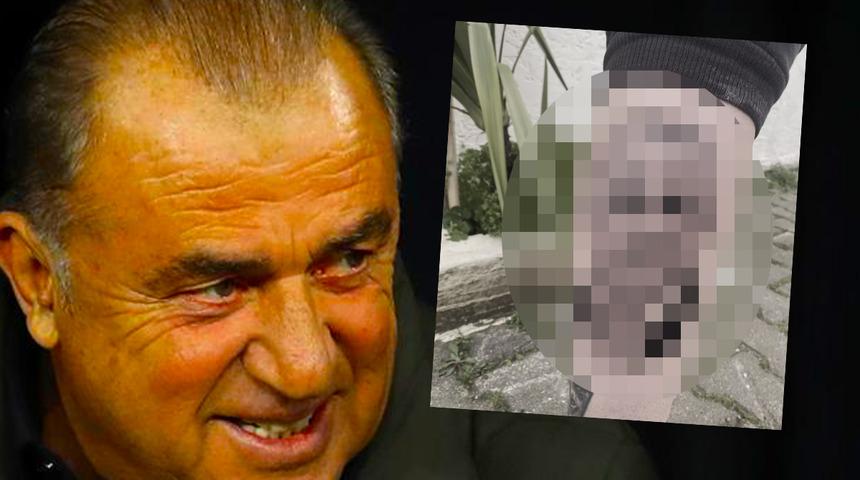 Yunanlar Fatih Terim aşkını vücuduna kazıdı! Panathinaikos taraftarından Terim dövmesi