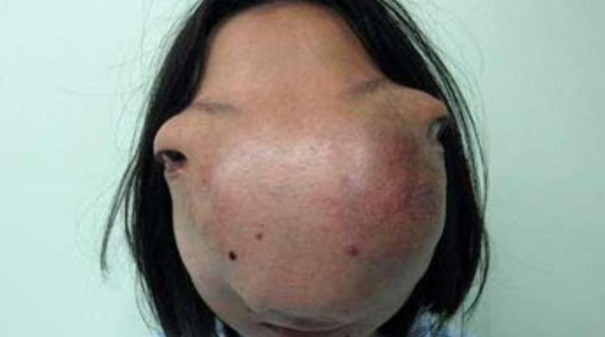 Bu &Ccedil;inliye doktorlar yardım edebilecek mi?