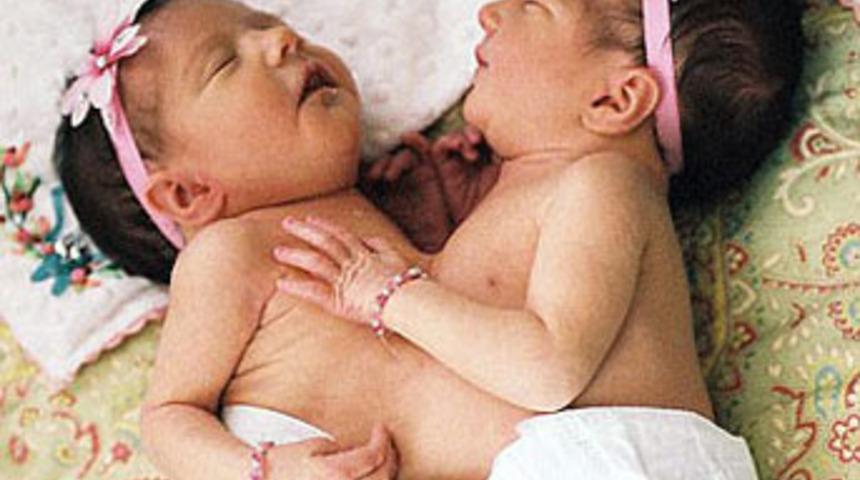 İkizlerle ilgili &ouml;l&uuml;mc&uuml;l karar