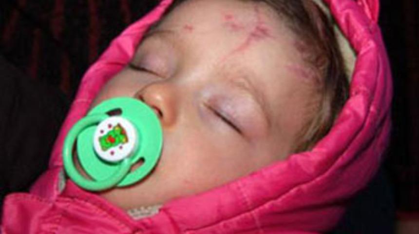 Anneyi &ouml;ld&uuml;ren taş, Minel'in hafızasını aldı