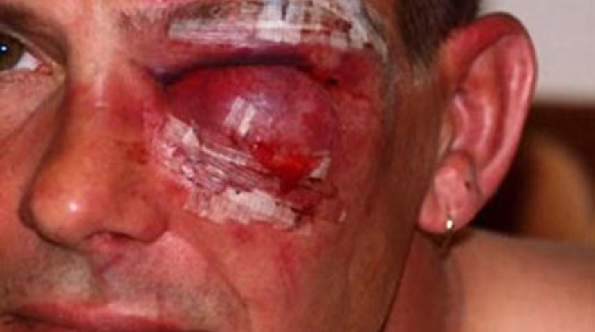 İngiliz askerler dehşet sa&ccedil;tı