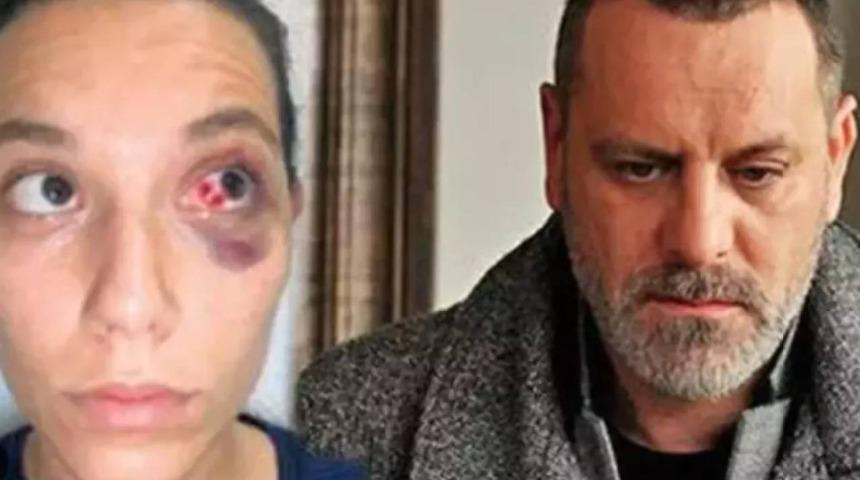 Ozan Güven ve Deniz Bulutsuz davasında yeni gelişme: Adli Tıp Kurumu raporu hazırlandı