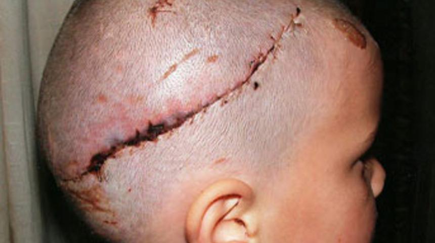 K&ouml;pek &ccedil;ocuğu par&ccedil;aladı