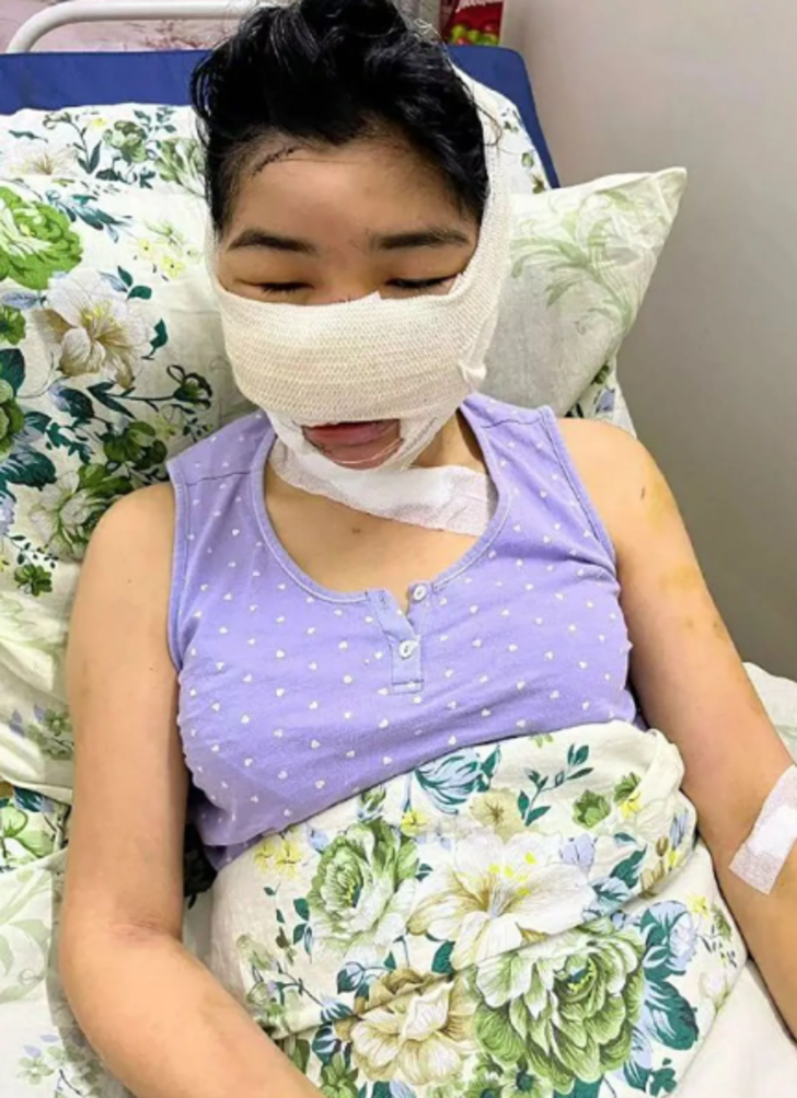 Boşanmayı hazmedemeyen eski eş dehşet saçtı! 10 yaşındaki çocuğunun gözü önünde eski karısına saldırdı... Kulağını ve burnunu kesti G1